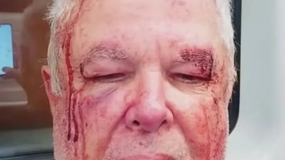 eleitor de esquerda é agredido